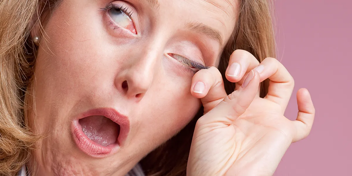 Close-up van een rood en geïrriteerd oog